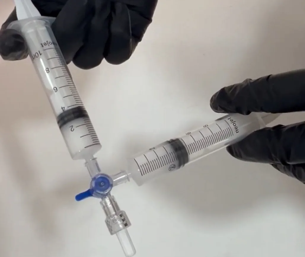 Bioestimulación con Radiesse EMG medicina estética