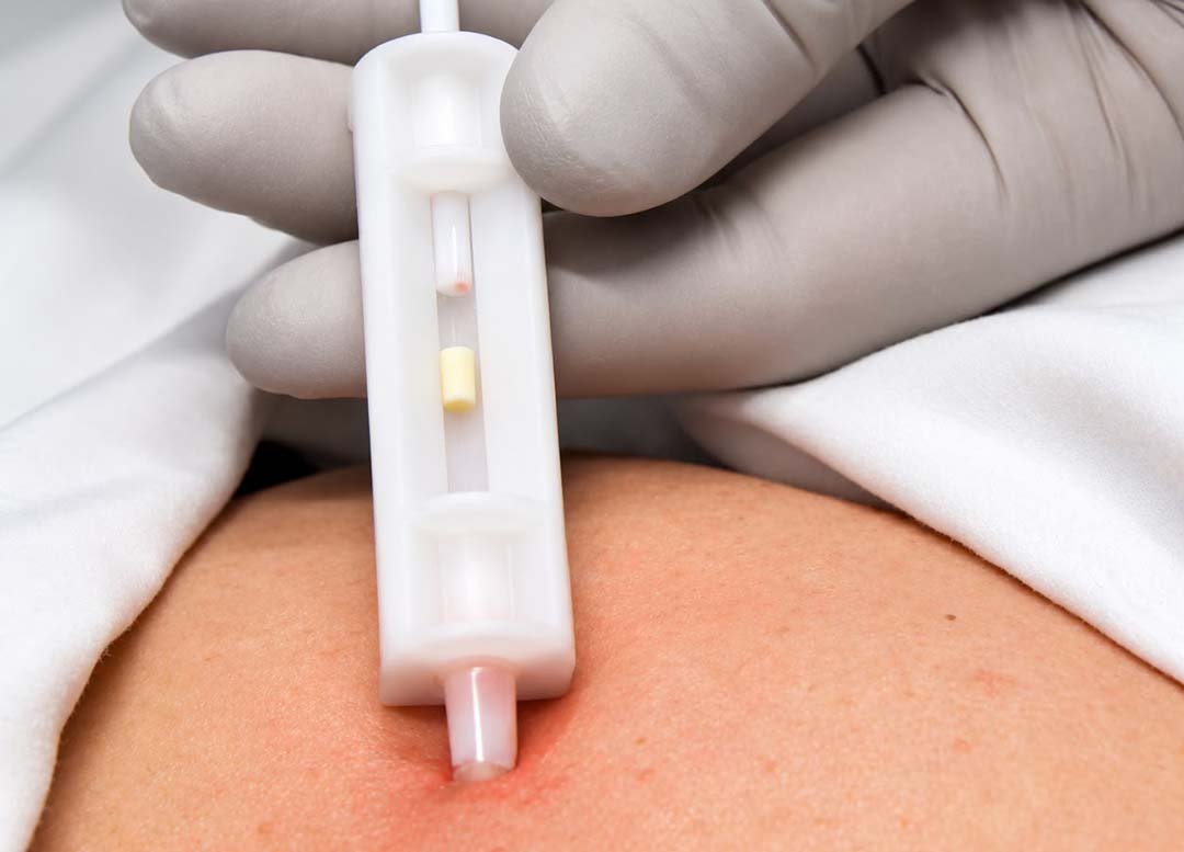 Terapia Hormonal Personalizada