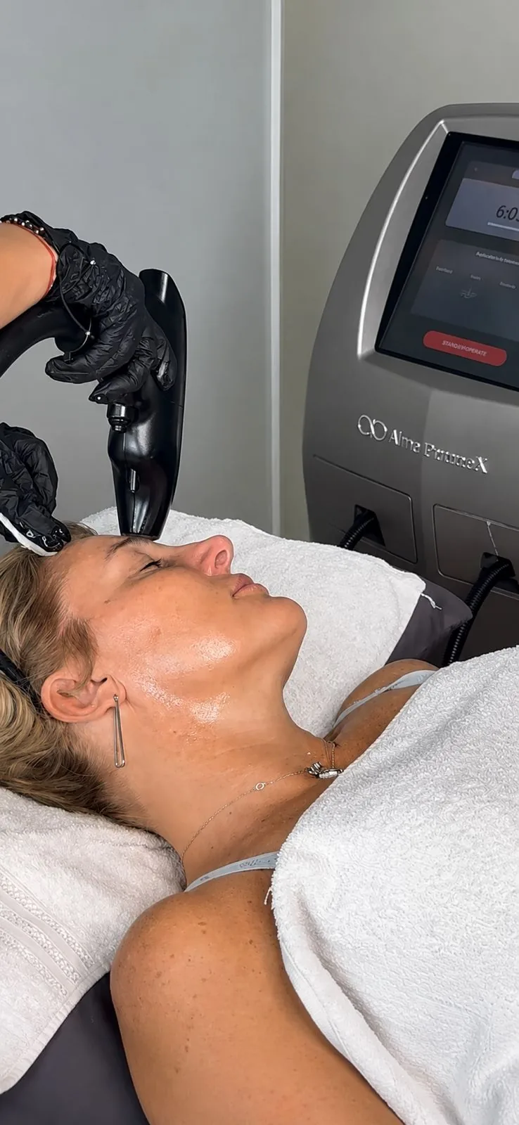 Tratamiento capilar plasma plaquetas