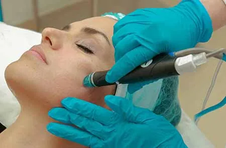 Dermapen microneedling tratamiento facial